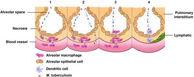 From pathogenesis to antigens: the key to shaping the future of TB vaccines